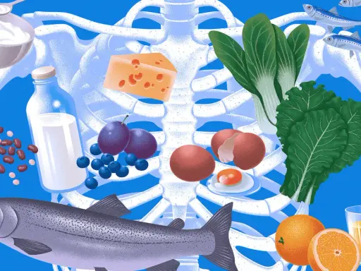 Alimentos clave para una dieta para osteoporosis: lácteos, pescado, huevos, verduras de hoja verde, frutas y legumbres, rodeando un esqueleto.